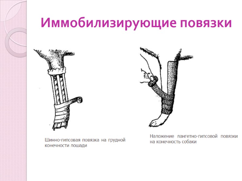 Иммобилизирующие повязки